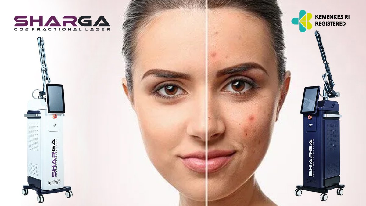 CO2 Fractional Laser Kecantikan: Manfaat, Cara Kerja, Hasil Treatment dan Harga Mesin untuk Klinik