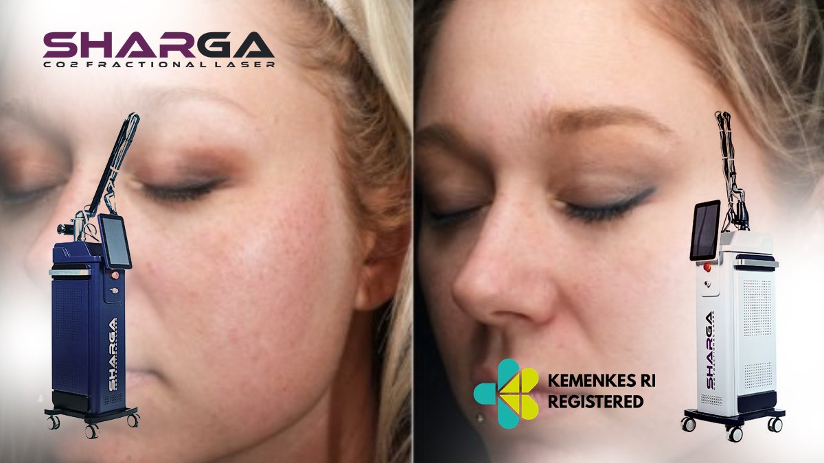 Hasil CO2 Fractional Laser Sebelum dan Sesudah Treatment