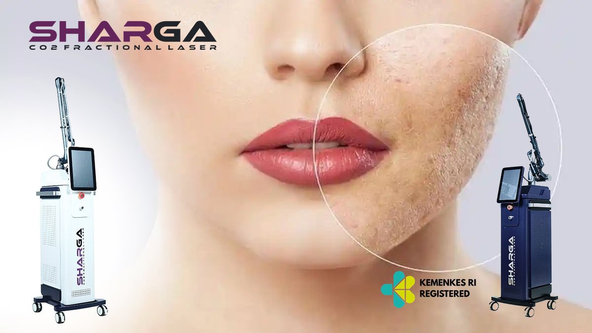 CO2 Fractional Laser untuk Bekas Jerawat dan Bopeng