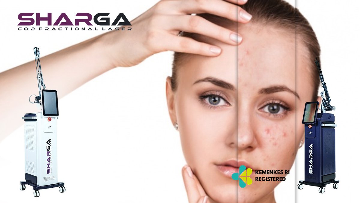 Cara Kerja CO2 Fractional Laser pada Kulit Wajah dan Teknologi di Baliknya