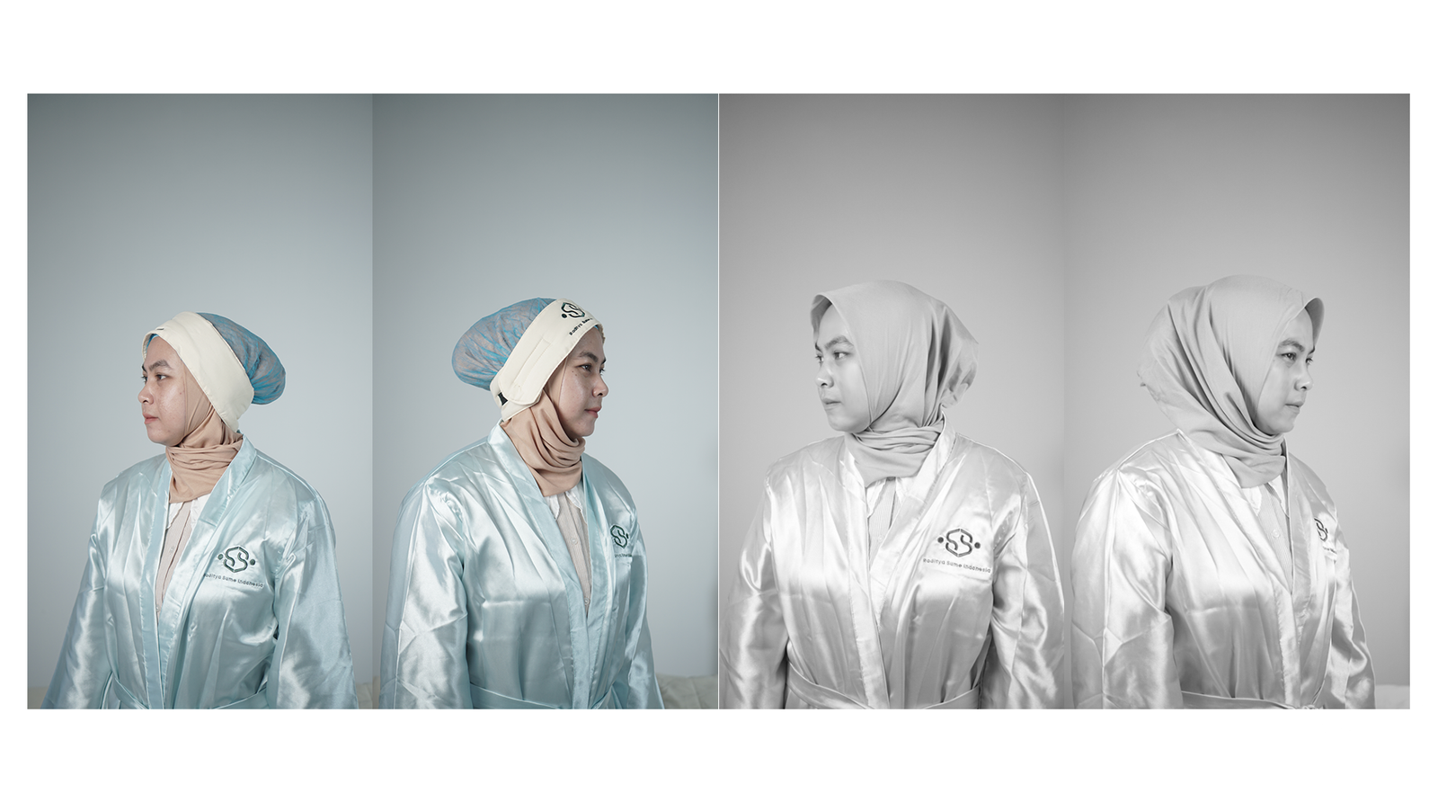 After Treatment Pico4glow - Picosecond Laser